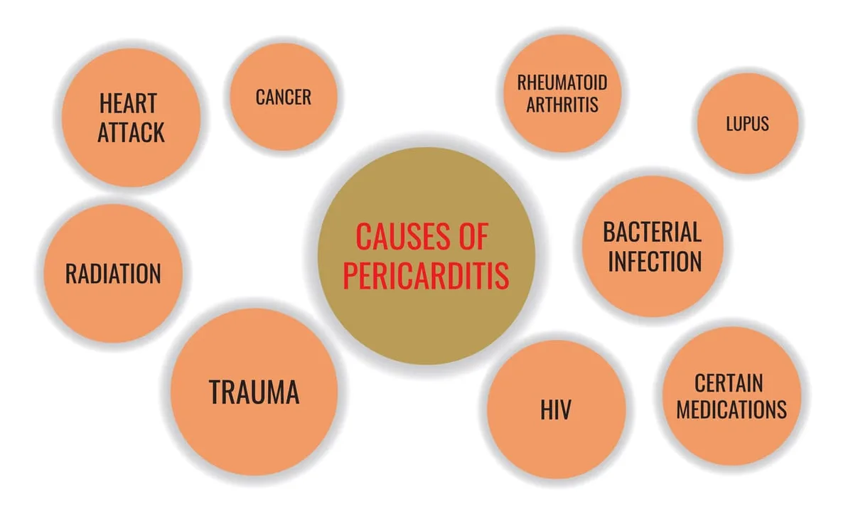 Causes Of Pericarditis 2