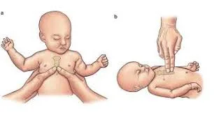 Chest Compression Neonate