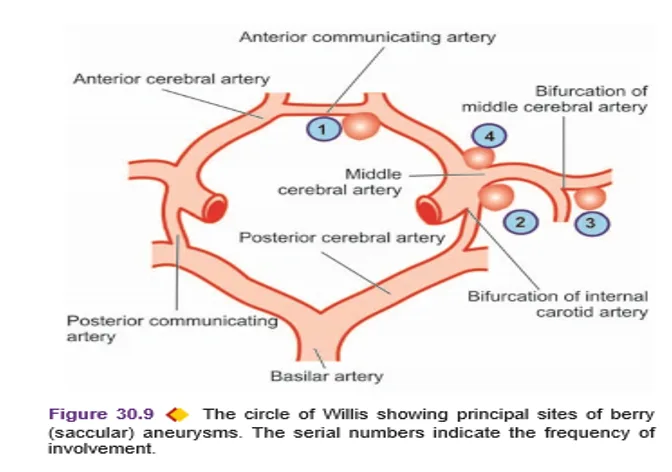 Circle Of Willis
