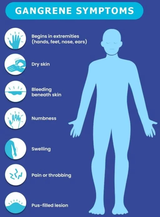 Clinical Features Of Gangrene 1