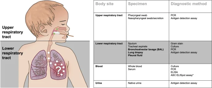 Diagnosis Of Pneumonia In Children 1