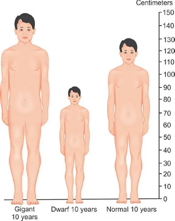 Dwarfism