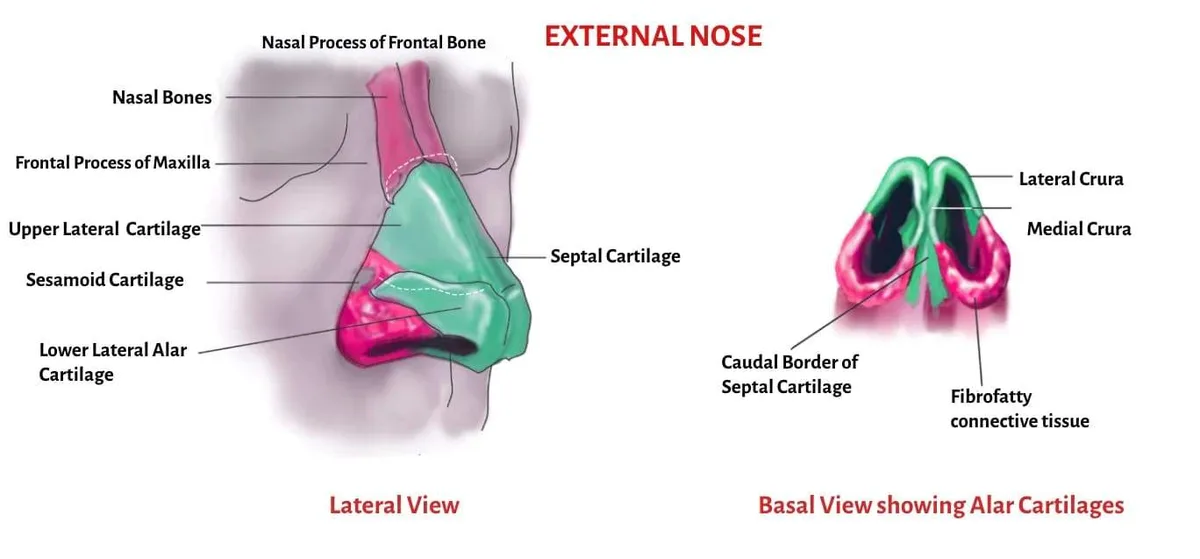 External Nose
