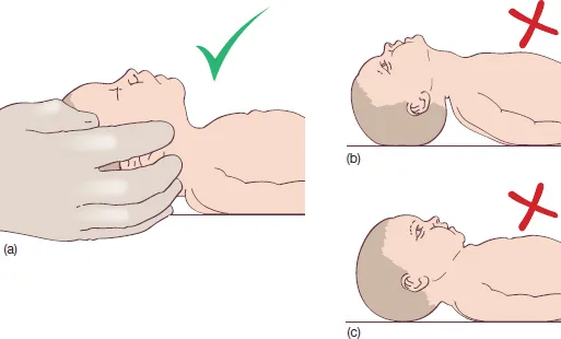 Infant Resuscitation
