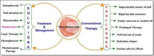 Management Of Onychomycosis