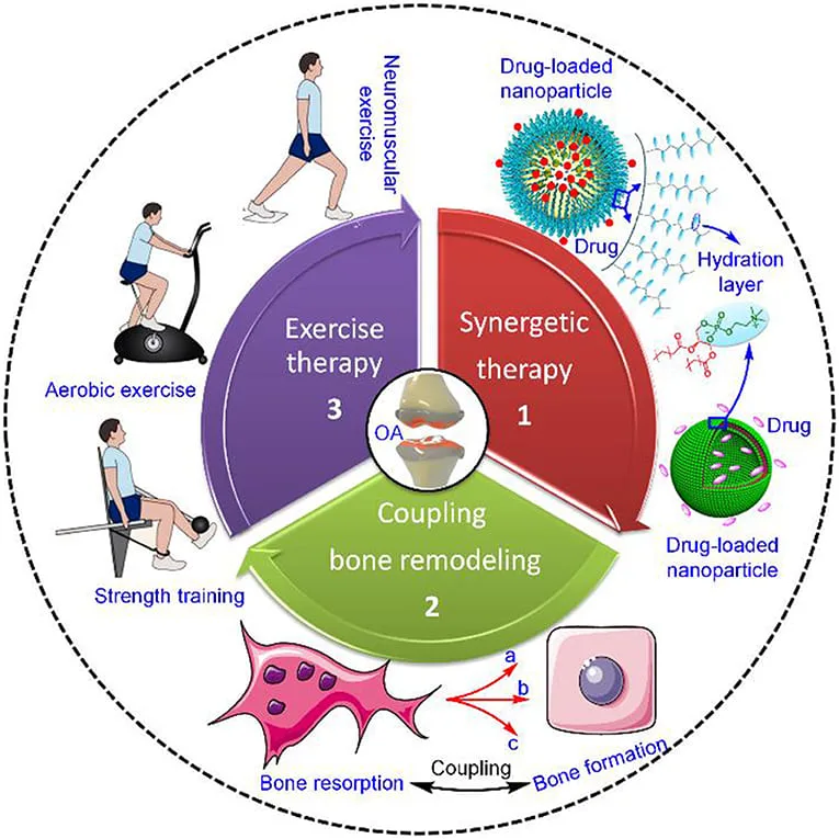 Osteoarthritis Management 1