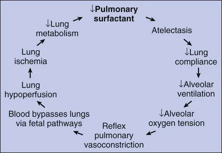 Pathophysiology Of Rds