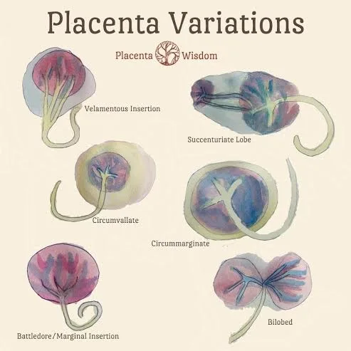 Placenta Variations