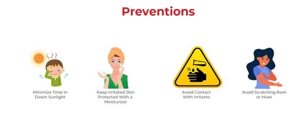 Prevention Prevention Of Skin Allergies