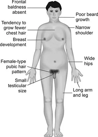 Signs Of Intersex