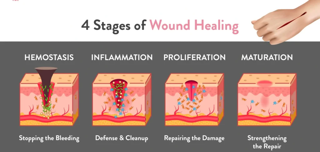 Stages Of Wound Healing 01 1 Scaled 1 E1742212334266