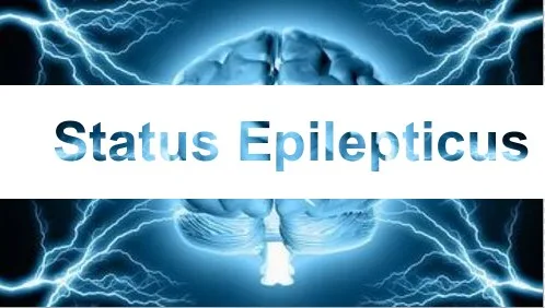Status Epilepticus Epilepsy