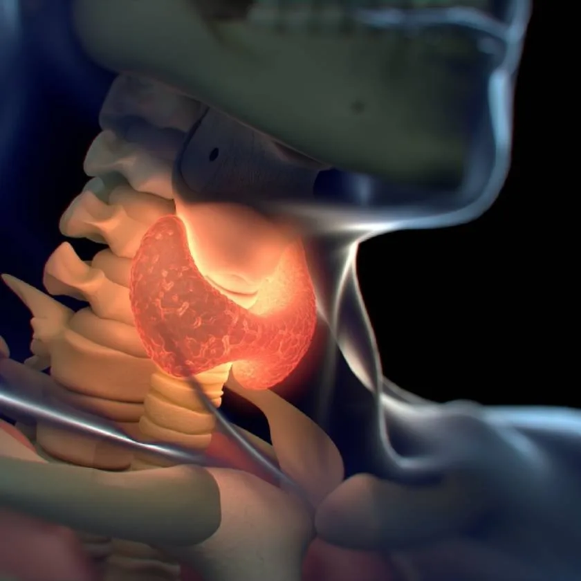 Thyrotoxicosis