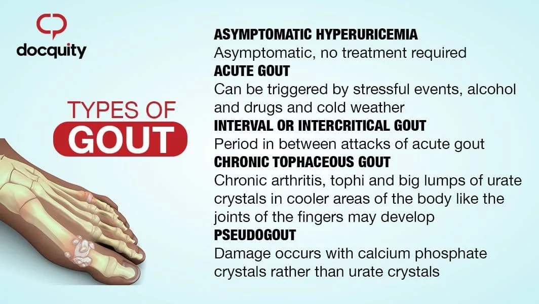 Types Of Gout 1
