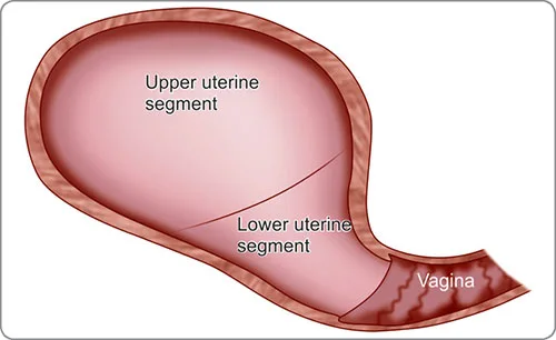 Upper And Lower