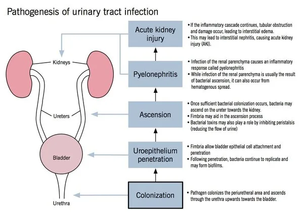 Uti Urinary Tract Infection Pathophysiology Original 1