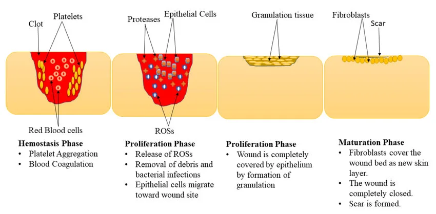 Wound Dressing Phases Of The Wound Healing Process