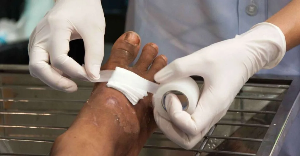 Wound Dressing 1